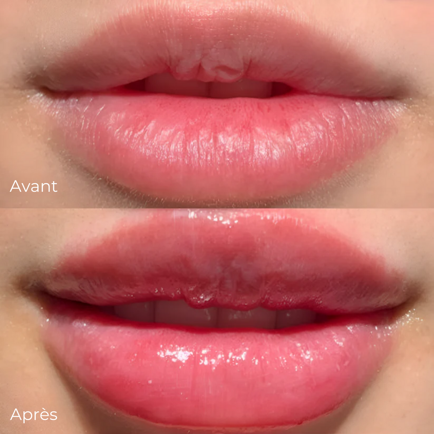 GlowLips - LipLift Set
